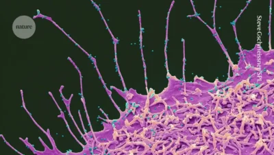 Pandemia cervello invecchiamento